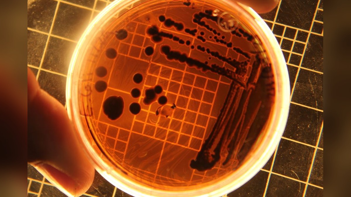 Goma de mascar bioengenheirada reduz HPV em até 93% em testes